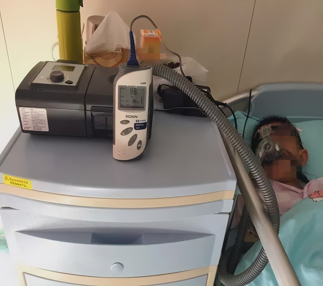 深院救治｜术前训练“懒汉”呼吸中枢为重度鼾症患儿创生机