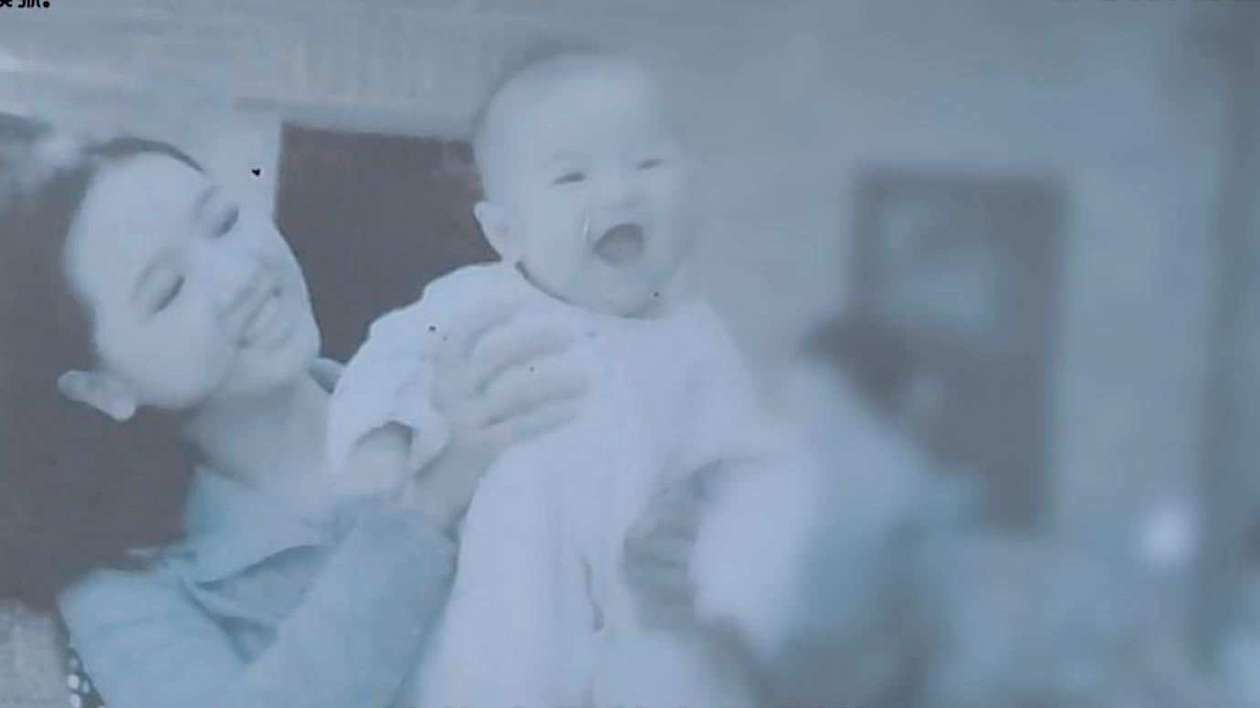 20岁小伙被重度烧伤七年后续,20岁严重烧伤毁容