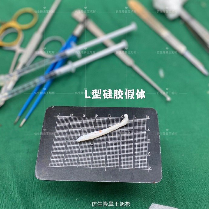 骨粉注射隆鼻皮肤变薄怎么办,线雕隆鼻会引起鼻挛缩吗