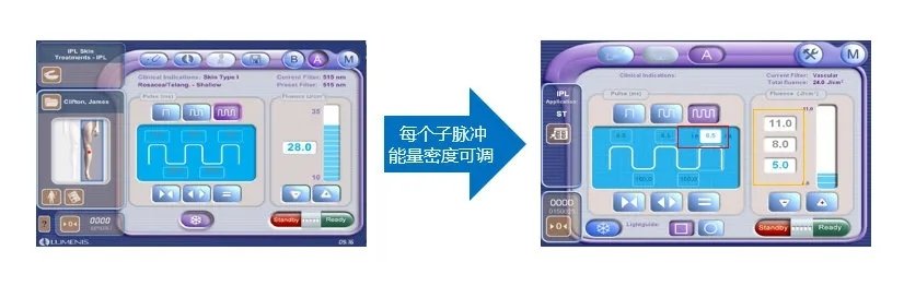 光子和超光子有什么区别,超光子比光子嫩肤贵吗