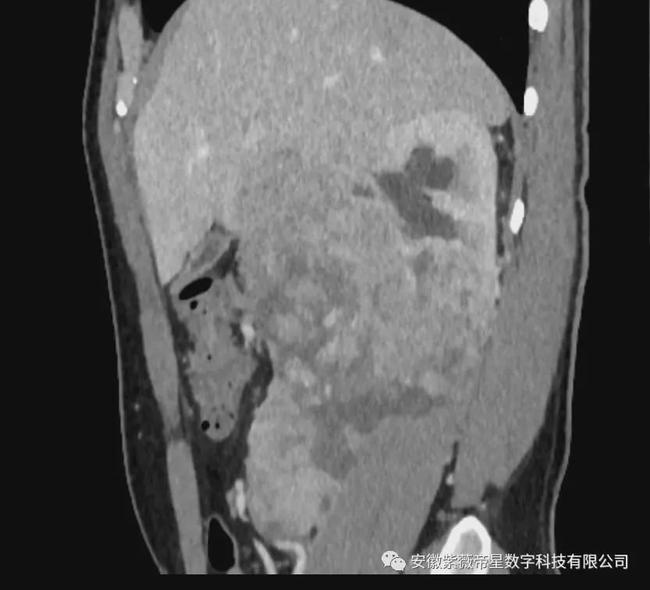 紫薇帝星穴,紫薇帝星医疗科技