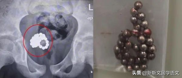 学校是否应该给孩子们提供性教育,学校有没有必要进行性教育