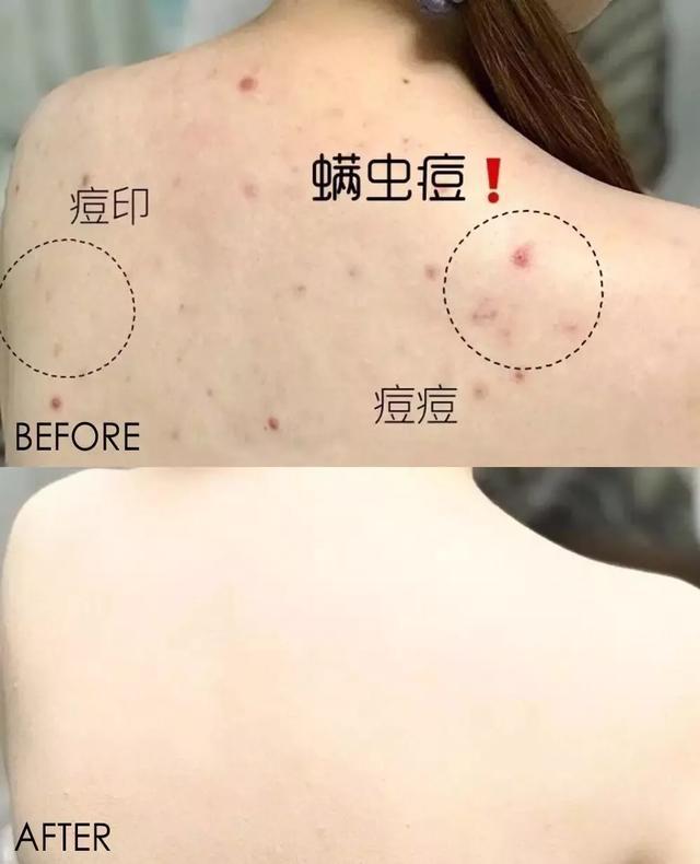 床单睡久了容易螨虫成窝？教你一新招，比太阳暴晒效果好