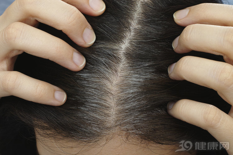 解救“白头”，除了染发，中医还有3个方法，为何不试？