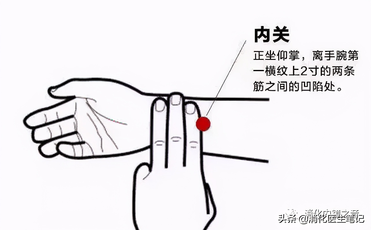 缓解孕期恶心呕吐的穴位,孕期恶心呕吐怎么缓解