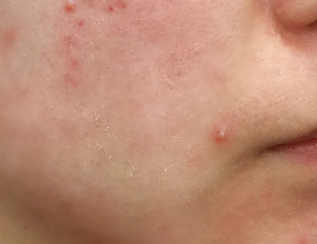 无需美颜轻松拥有水光肌,哪有天生的好底子