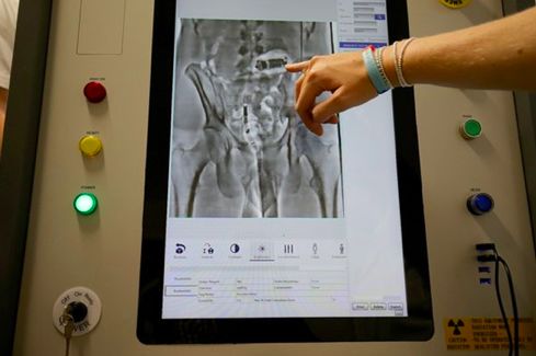 英国首相约翰逊目睹囚犯体内藏毒扫描照，竟被吓得连连*退倒**