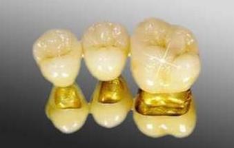 烤瓷牙修复缺陷图片,做了烤瓷牙后悔了有补救办法吗