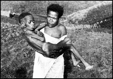 整天笑死了是什么病,笑死症是什么原因引起的