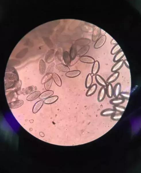 4岁小女孩老喊屁屁痒，妈妈脱下她裤子后惊呆：许多小虫子！还在动