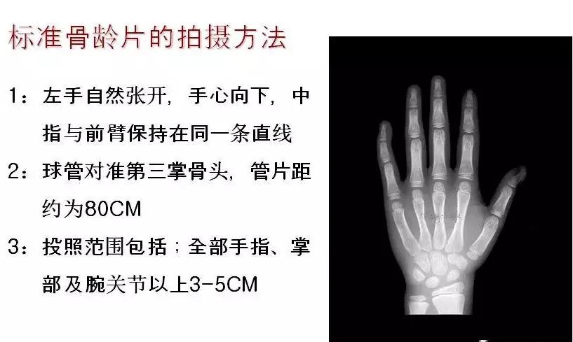 孩子个子高却跑不快,小孩个头不高