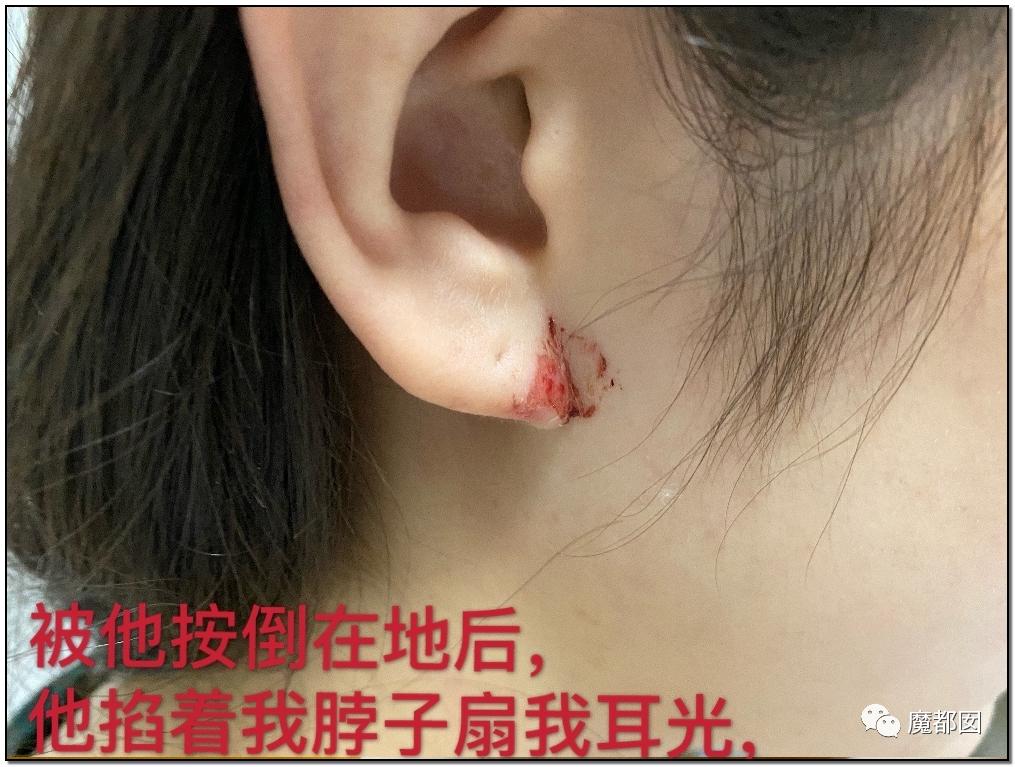 短跑名将张培萌被曝家暴,短跑名将张培萌殴打岳母被行拘