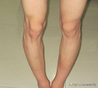 一个动作判断你是不是翘臀,你以为的翘臀很可能是骨盆前倾