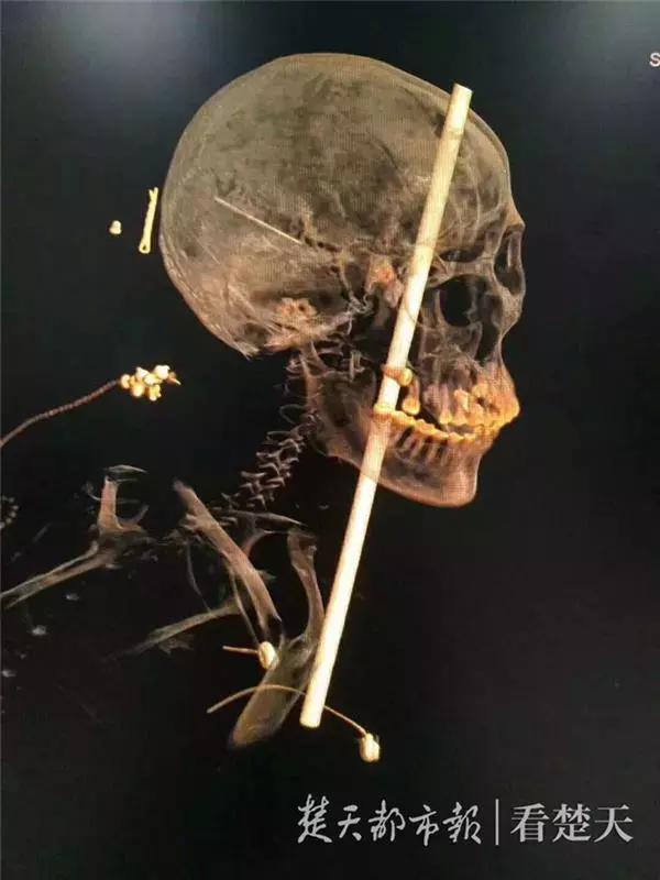 小区装24个摄像头被曝光,这个小区装了24个高清摄像头