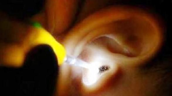 6岁小孩半夜说耳朵疼有什么办法,四岁孩子半夜说耳朵痛去哪个科