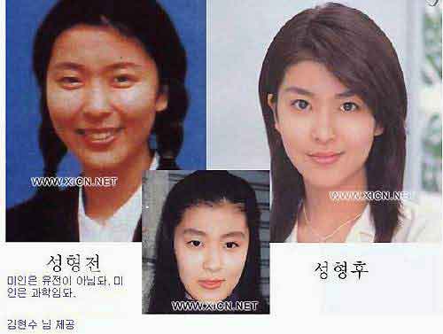 日本整容的鬼斧神工，来见识一下各位日星是整容了还是“长开”了