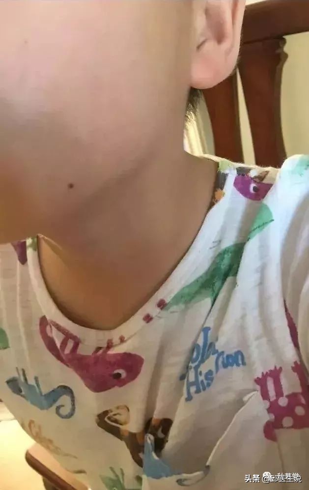 皮肤瘙痒的外洗中药,中药外洗治疗顽固性皮肤瘙痒