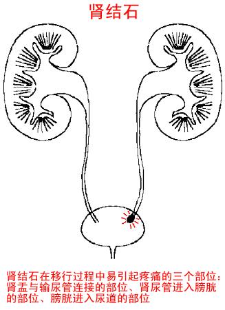 痛风吃什么中药有效治好,痛风吃什么药最快缓解