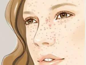 县医院美容科能祛斑吗,医院美容科祛斑全过程