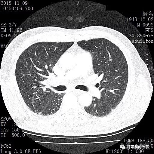 怎么应用统计学做调查,统计学方法可以解决的主要问题