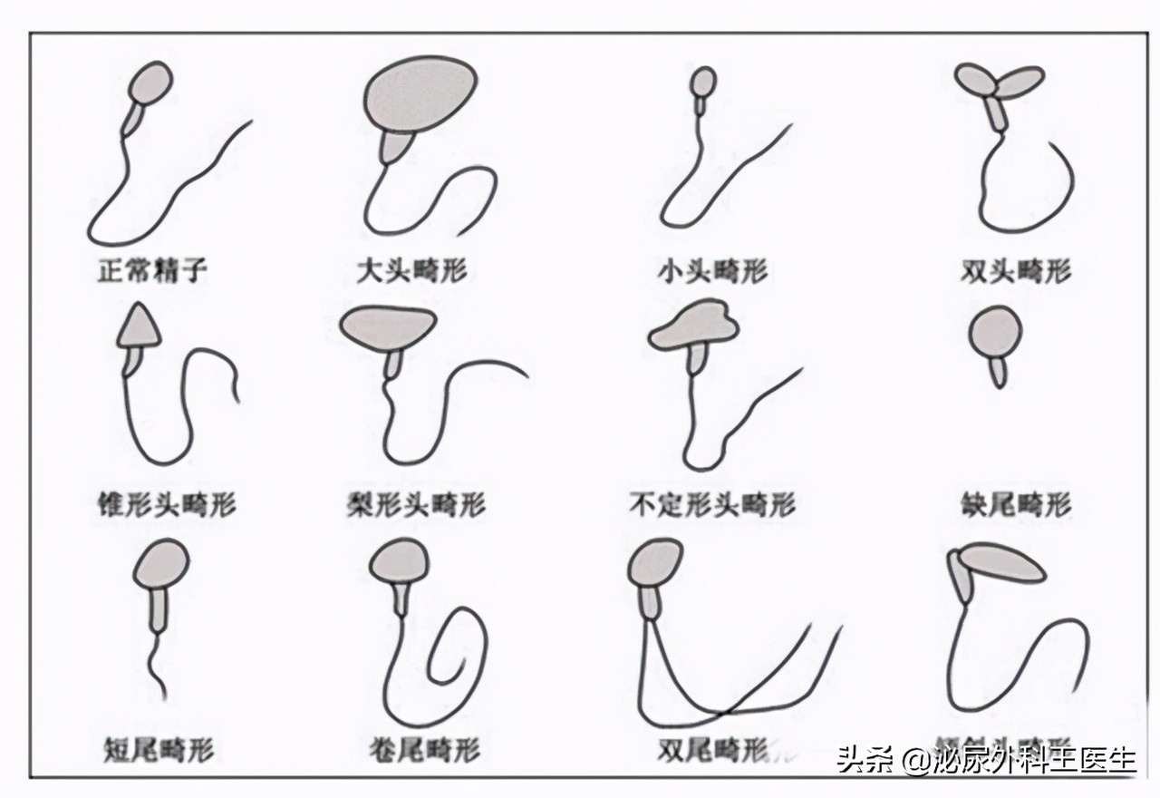 影响精子质量都有哪些因素,精子质量差如何提高精子质量