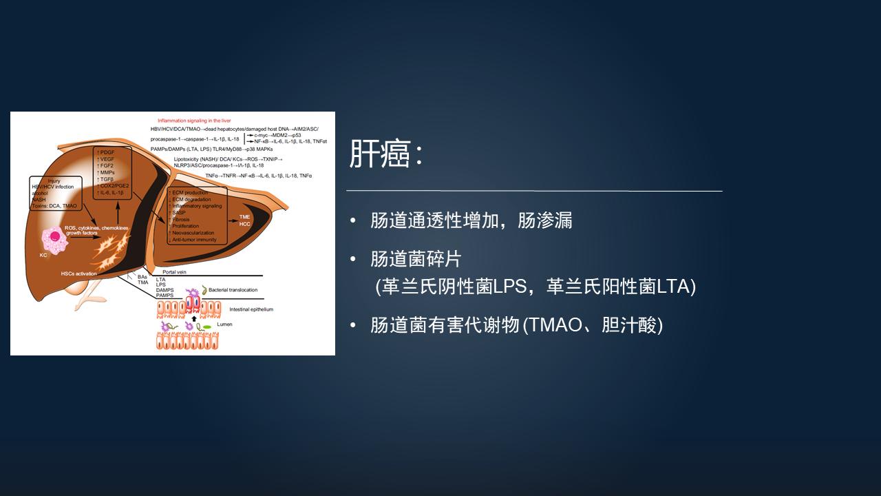 「图文实录」郑晓皎：18分钟详解菌群-胆汁酸与消化系统肿瘤