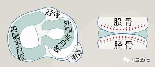 半月板最怕的动作别再做了,半月板损伤错误治疗