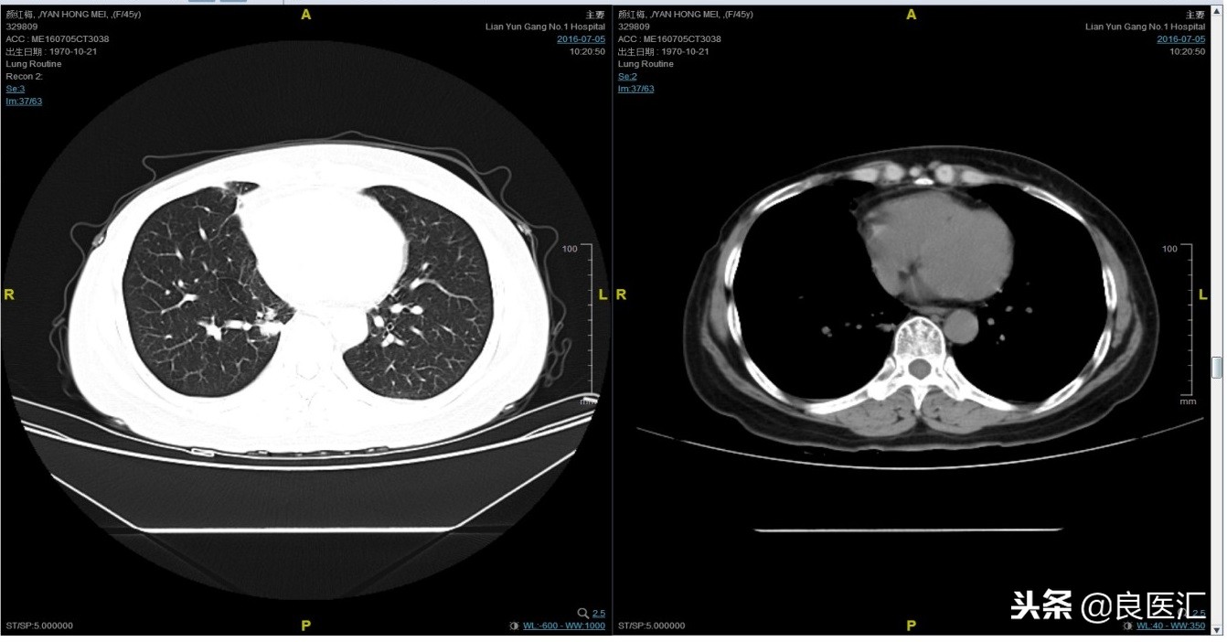 美图秀秀成功案例,美图秀秀实战案例