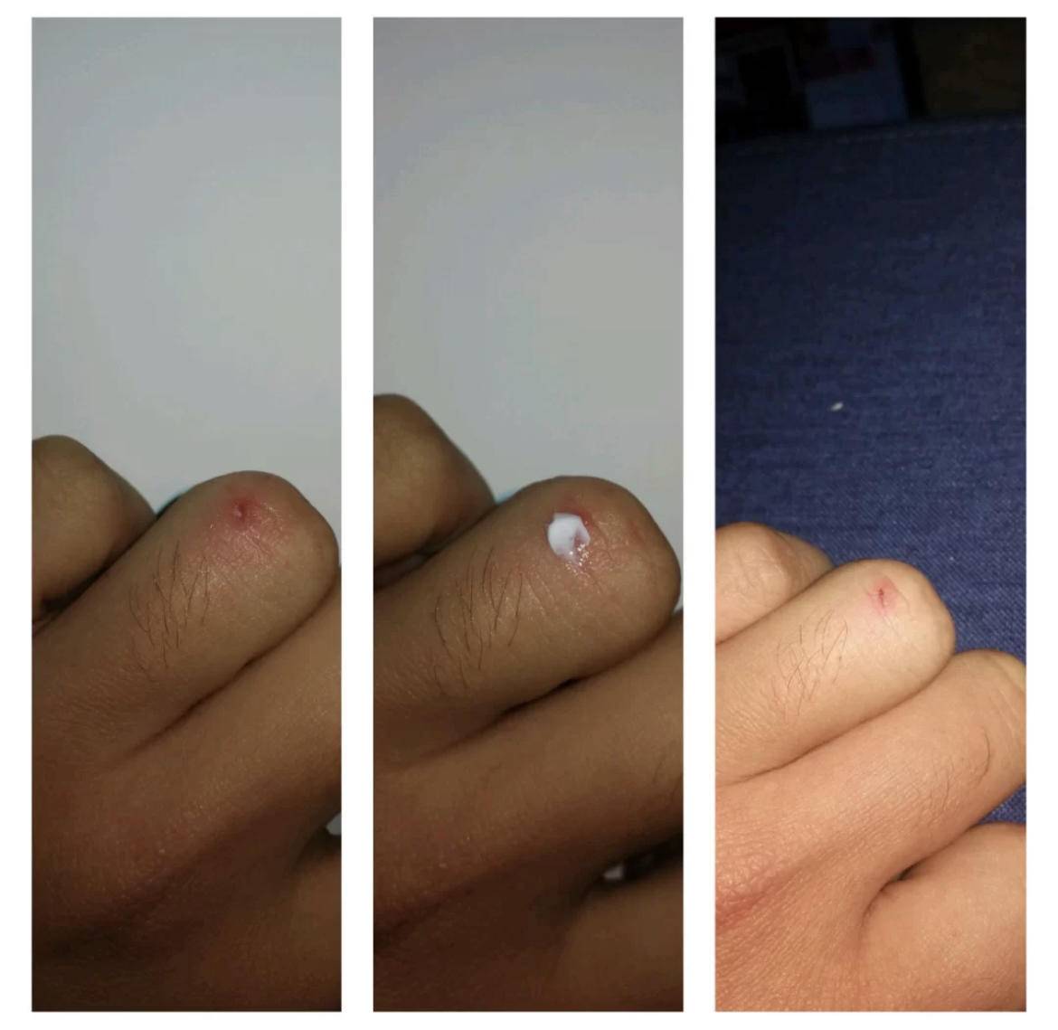 容貌焦虑真的是太难了,容貌焦虑是怎么来的