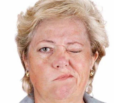 贝尔面瘫也会出现耳后不舒服吗,贝尔面瘫能完全痊愈不