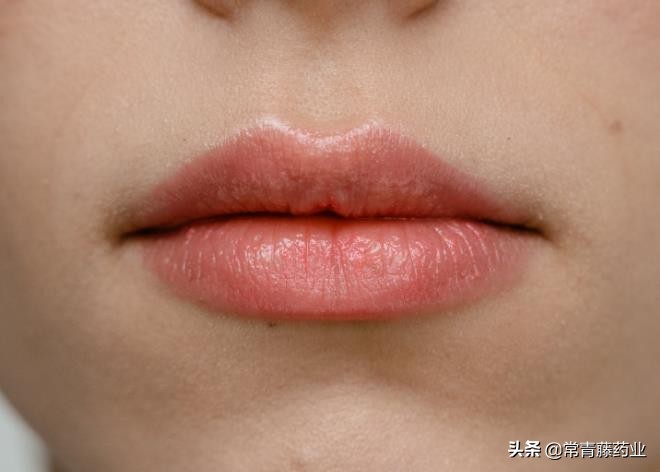 嘴唇反反复复的痒脱皮什么原因,嘴唇脱皮痒是什么原因引起的