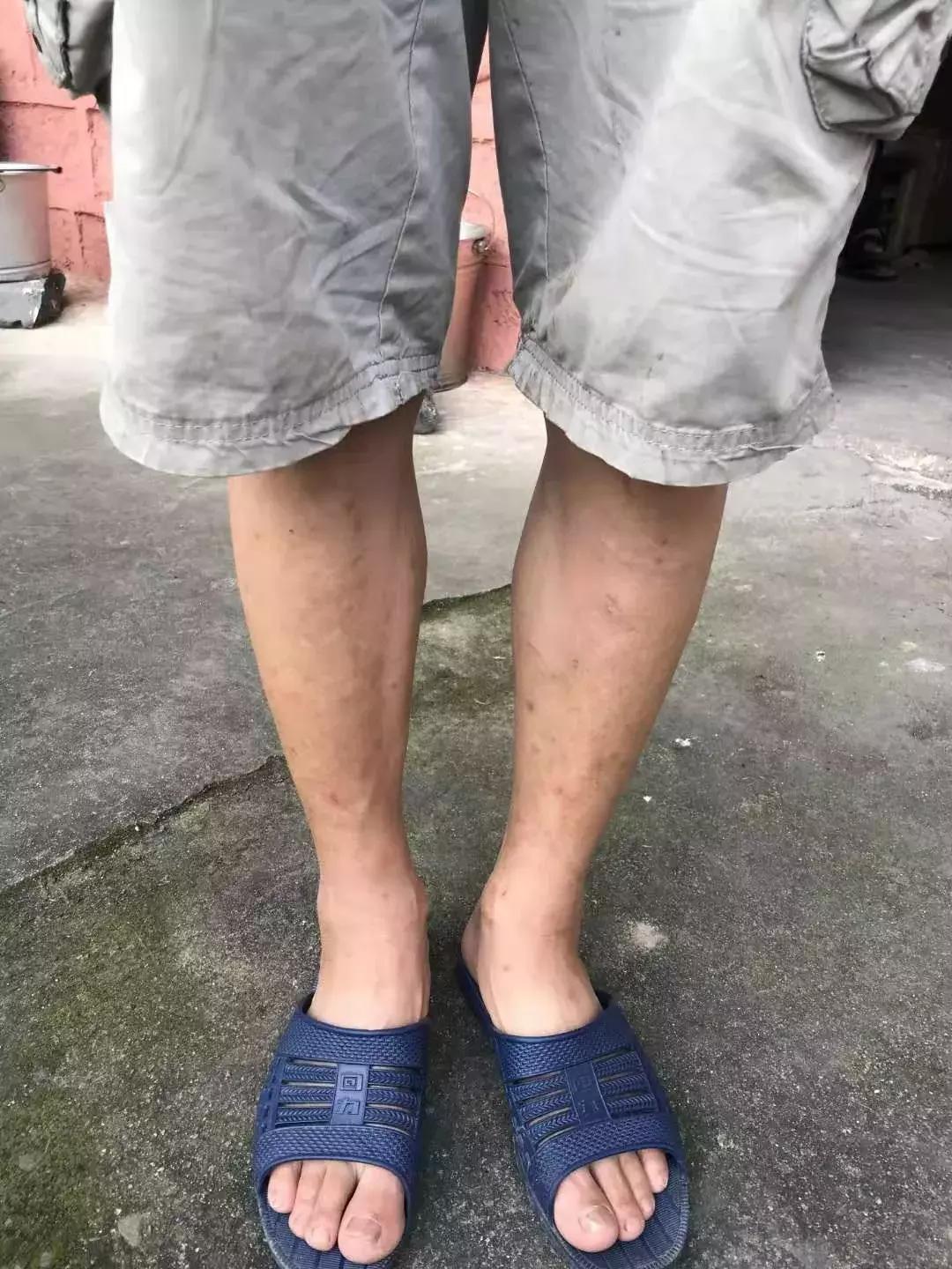 致敬最美逆行者白衣天使,致敬危难时刻的逆行者