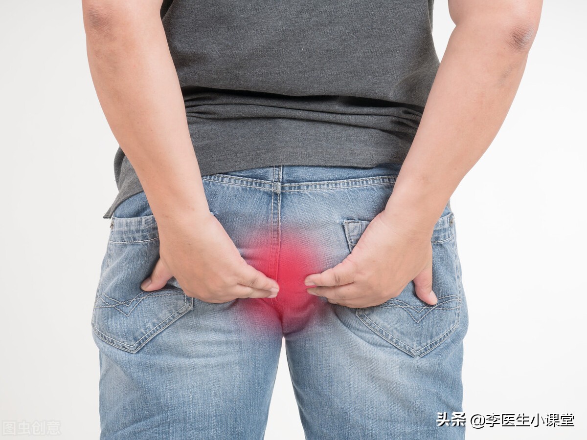 吃什么痔疮药能消痔疮肉球呢,怎么办才能使痔疮的小肉球消退