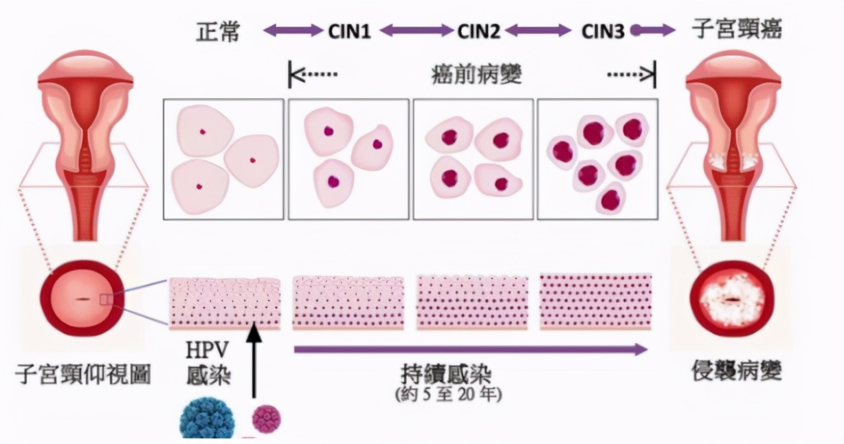 一文讲透，宫颈癌疫苗到底有没有必要打？