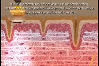 有什么是真正的美容仪,美容仪是用的什么原理