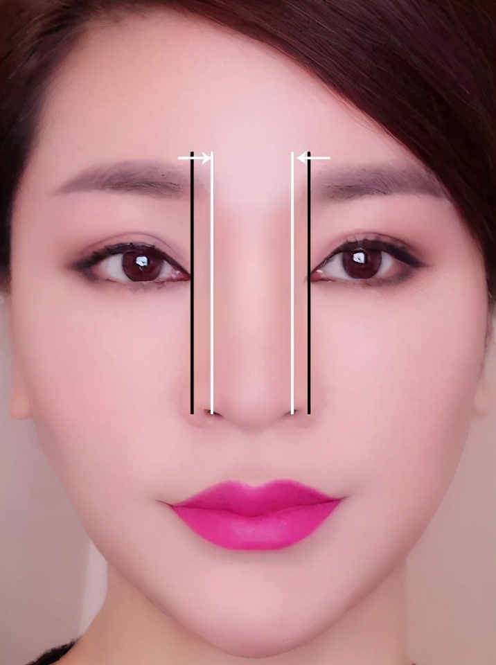 简单高鼻梁怎么做出来,目前最先进的做高鼻梁的方法