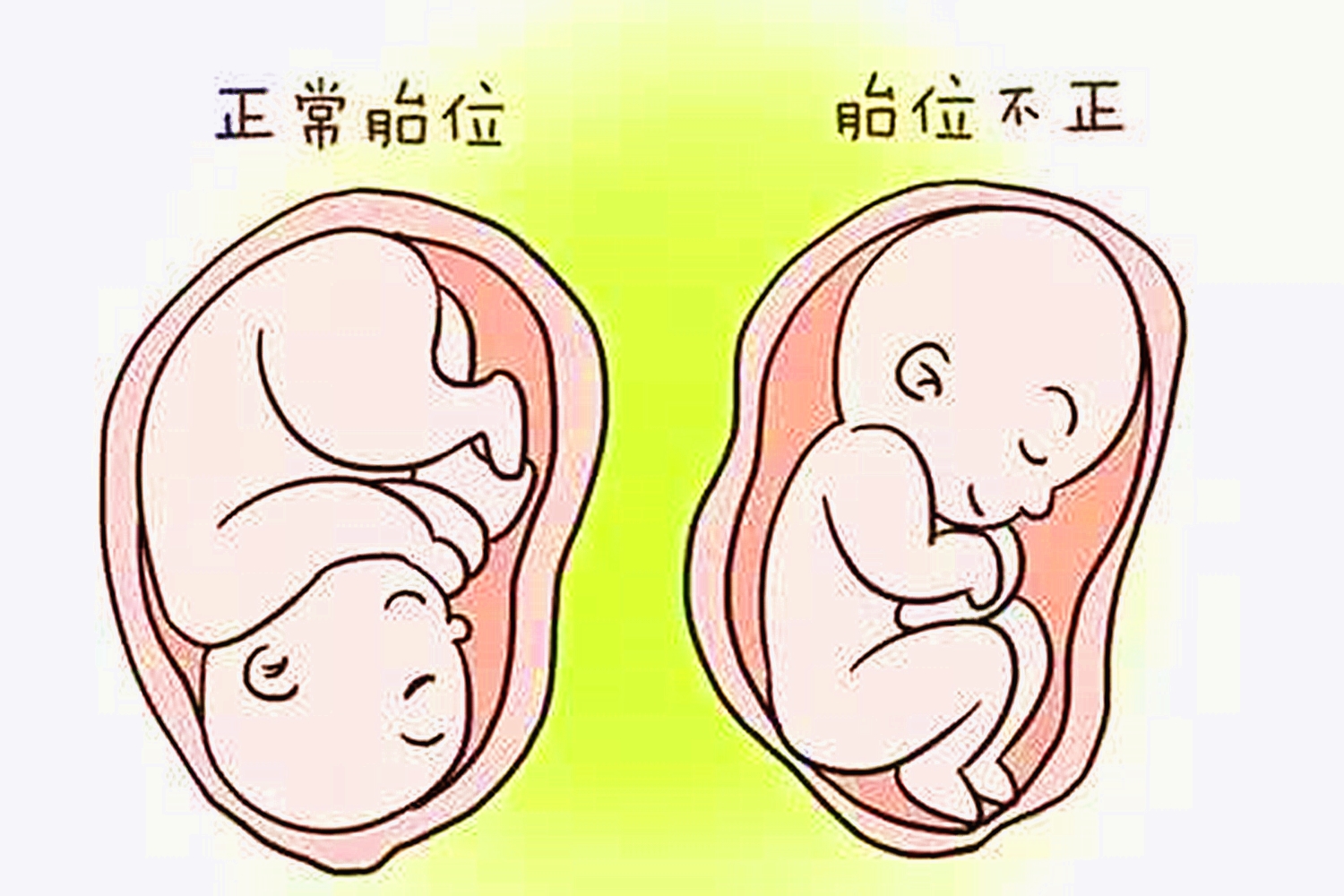 胎儿会打嗝是不是证明不缺氧,胎儿打嗝是不是胎动也正常