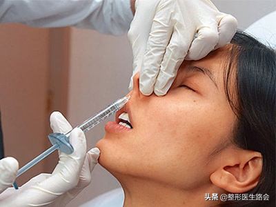 玻尿酸隆鼻副作用图片,玻尿酸隆鼻好不好优势有哪些