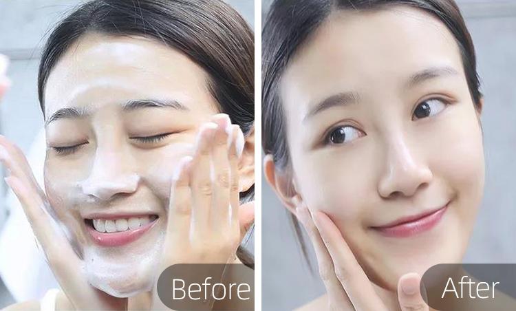 混合性肌肤毛孔粗大如何改善,改善毛孔粗大出油的方法