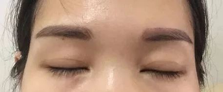 请别再怀疑潘贰做双眼皮手术切肌肉了，希望这是我最后一次澄清