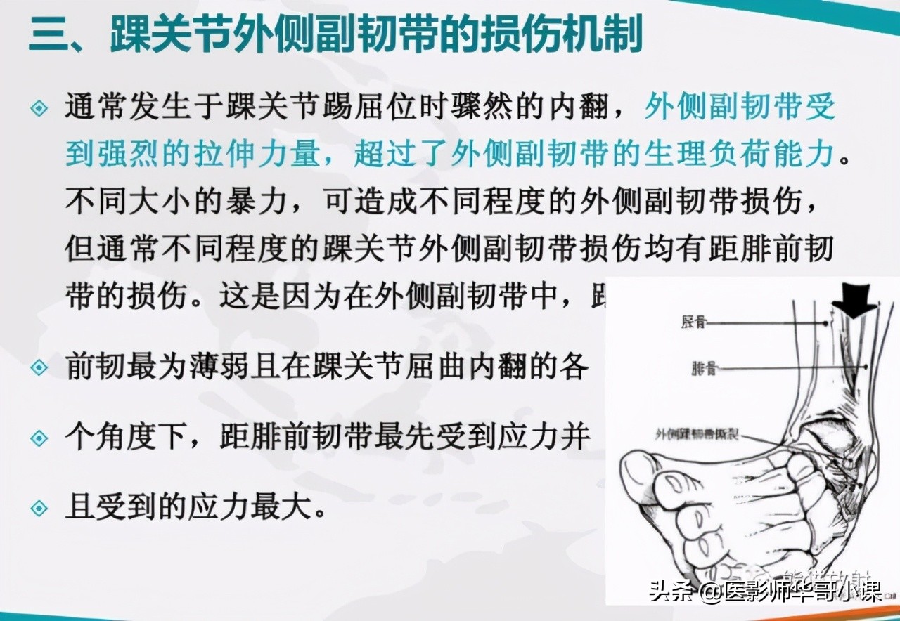 踝关节解剖视频课,解剖学韧带分布图