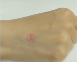 皮肤发痒抹炉甘石就好什么原因,皮肤痒擦炉甘石有用吗