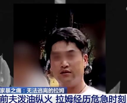 网红拉姆直播被烧的现场,网红拉姆遭前夫焚烧重度烧伤