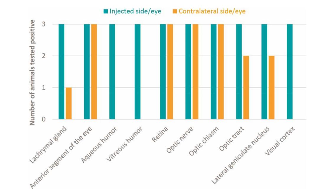 基因治疗青光眼的新消息,基因治疗青光眼的最新消息