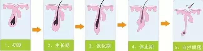 防脱的几种情况,防脱问题图