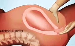 胎盘滞留子宫有什么后果,胎盘剥离不全为什么导致胎盘滞留