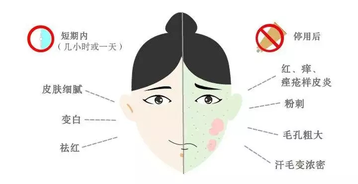 断激素后症状,什么叫断激素过敏反应