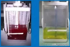 肺癌胸水消失了但气喘严重,肺癌晚期每天抽胸水能活多久