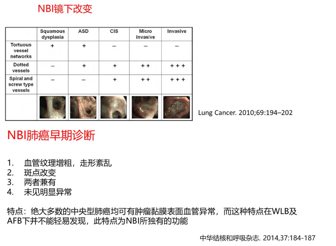 全球对肺癌治疗的最有效最新技术,肺癌的支气管镜介入治疗
