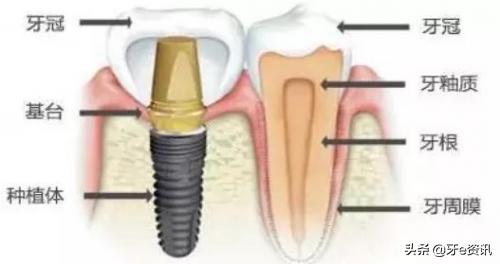 为何说“金眼银牙”？口腔中的“高富帅”有哪些？